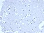 TACSTD2/TROP2 (Epithelial Marker) Antibody in Immunohistochemistry (Paraffin) (IHC (P))