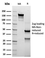 TACSTD2/TROP2 (Epithelial Marker) Antibody in SDS-PAGE (SDS-PAGE)