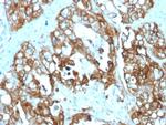 TACSTD2/TROP2 (Epithelial Marker) Antibody in Immunohistochemistry (Paraffin) (IHC (P))