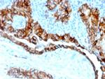 TACSTD2/TROP2 Antibody in Immunohistochemistry (Paraffin) (IHC (P))