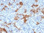 TACSTD2/TROP2 Antibody in Immunohistochemistry (Paraffin) (IHC (P))