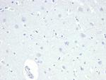 TACSTD2/TROP2 Antibody in Immunohistochemistry (Paraffin) (IHC (P))