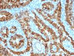 TACSTD2/TROP2 Antibody in Immunohistochemistry (Paraffin) (IHC (P))