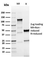 TACSTD2/TROP2 Antibody in SDS-PAGE (SDS-PAGE)