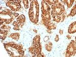 TACSTD2/TROP2 (Epithelial Marker) Antibody in Immunohistochemistry (Paraffin) (IHC (P))