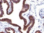 Ep-CAM/CD326 (Extracellular Domain) (Epithelial Marker) Antibody in Immunohistochemistry (Paraffin) (IHC (P))