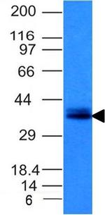 Ep-CAM/CD326 (Extracellular Domain) (Epithelial Marker) Antibody in Western Blot (WB)