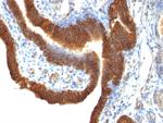 Ep-CAM/CD326 (Extracellular Domain) (Epithelial Marker) Antibody in Immunohistochemistry (Paraffin) (IHC (P))