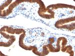 Ep-CAM/CD326 (Extracellular Domain) (Epithelial Marker) Antibody in Immunohistochemistry (Paraffin) (IHC (P))