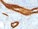 EpCAM/CD326 (Epithelial Marker) Antibody in Immunohistochemistry (Paraffin) (IHC (P))