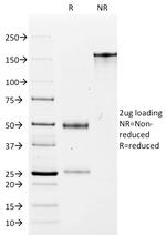 EpCAM/CD326 (Epithelial Marker) Antibody in SDS-PAGE (SDS-PAGE)