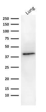 EpCAM/CD326 (Epithelial Marker) Antibody in Western Blot (WB)