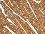 EpCAM/CD326 (Epithelial Marker) Antibody in Immunohistochemistry (Paraffin) (IHC (P))