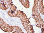 Ep-CAM/CD326 Antibody in Immunohistochemistry (Paraffin) (IHC (P))