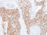 Ep-CAM/CD326 (Epithelial Marker) Antibody in Immunohistochemistry (Paraffin) (IHC (P))