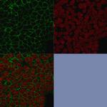 Ep-CAM/CD326 (Epithelial Marker) Antibody in Immunocytochemistry (ICC/IF)