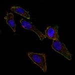 Ep-CAM/CD326 (Extracellular Domain) (Epithelial Marker) Antibody in Immunocytochemistry (ICC/IF)