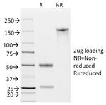 Ep-CAM/CD326 (Extracellular Domain) (Epithelial Marker) Antibody in SDS-PAGE (SDS-PAGE)