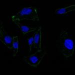 Ep-CAM/CD326 Antibody in Immunocytochemistry (ICC/IF)