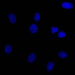 Ep-CAM/CD326 Antibody in Immunocytochemistry (ICC/IF)