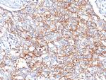 EpCAM/CD326 (Epithelial Marker) Antibody in Immunohistochemistry (Paraffin) (IHC (P))