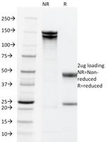 EpCAM/CD326 (Epithelial Marker) Antibody in SDS-PAGE (SDS-PAGE)