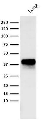 EpCAM/CD326 (Epithelial Marker) Antibody in Western Blot (WB)