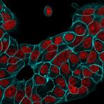 Ep-CAM/CD326 Antibody in Immunocytochemistry (ICC/IF)