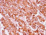 Ep-CAM/CD326 Antibody in Immunohistochemistry (Paraffin) (IHC (P))