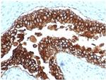 Ep-CAM/CD326 Antibody in Immunohistochemistry (Paraffin) (IHC (P))