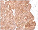 Ep-CAM/CD326 Antibody in Immunohistochemistry (Paraffin) (IHC (P))