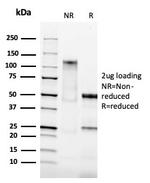 Ep-CAM/CD326 Antibody in SDS-PAGE (SDS-PAGE)