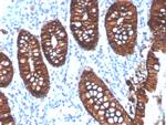 EpCAM/CD326 Antibody in Immunohistochemistry (Paraffin) (IHC (P))