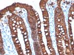 EpCAM/CD326 Antibody in Immunohistochemistry (Paraffin) (IHC (P))