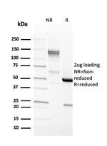 EpCAM/CD326 Antibody in SDS-PAGE (SDS-PAGE)