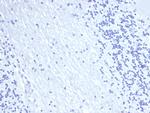 EpCAM/CD326 Antibody in Immunohistochemistry (Paraffin) (IHC (P))