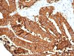 EpCAM/CD326 (Epithelial Marker) Antibody in Immunohistochemistry (Paraffin) (IHC (P))