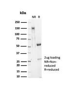 EpCAM/CD326 (Epithelial Marker) Antibody in SDS-PAGE (SDS-PAGE)