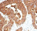 EpCAM/CD326 (Cytoplasmic Domain) (Epithelial Marker) Antibody in Immunohistochemistry (Paraffin) (IHC (P))