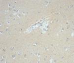 EpCAM/CD326 (Cytoplasmic Domain) (Epithelial Marker) Antibody in Immunohistochemistry (Paraffin) (IHC (P))