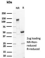 EpCAM/CD326 (Cytoplasmic Domain) (Epithelial Marker) Antibody in SDS-PAGE (SDS-PAGE)