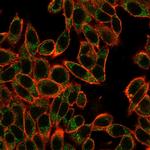 SMAD3 Antibody in Immunocytochemistry (ICC/IF)