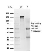 SMAD3 Antibody in SDS-PAGE (SDS-PAGE)