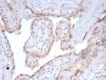 SMAD4 (Pancreatic Adenocarcinoma Marker) Antibody in Immunohistochemistry (Paraffin) (IHC (P))