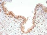 SMAD4 (Pancreatic Adenocarcinoma Marker) Antibody in Immunohistochemistry (Paraffin) (IHC (P))