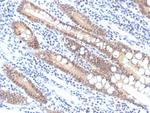 SMAD4/DPC4 (Pancreatic Adenocarcinoma Marker/Tumor Suppressor) Antibody in Immunohistochemistry (Paraffin) (IHC (P))