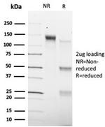 SMAD9 Antibody in SDS-PAGE (SDS-PAGE)