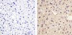 ANGPTL4 Antibody in Immunohistochemistry (Paraffin) (IHC (P))