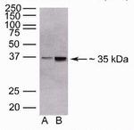 ANGPTL4 Antibody in Western Blot (WB)