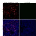 Ki-67 Antibody in Immunohistochemistry (Paraffin) (IHC (P))